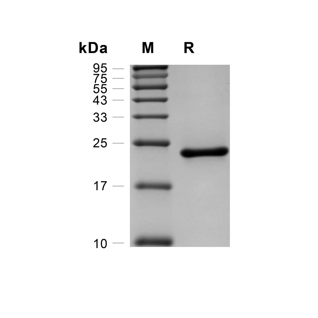 RBP4蛋白, Cynomolgus (HEK293, His)