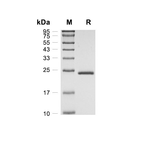 PRL2A1蛋白, Rat (HEK293, His)
