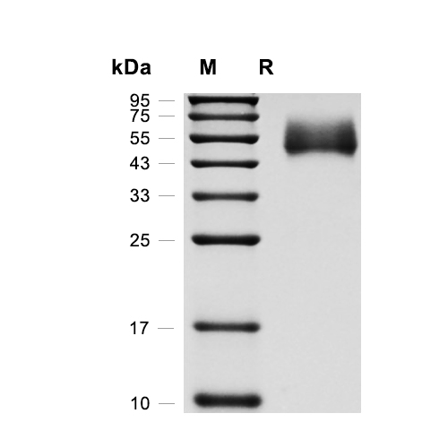 Nectin-1蛋白, Rat (HEK293, His)