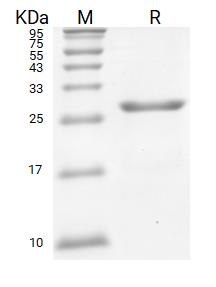 IDI2蛋白, Human (C-His)