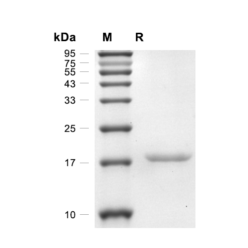 Leptin蛋白, Rat (His)