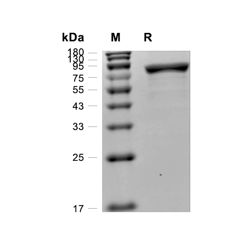 O-GlcNAcase/OGA蛋白, B. thetaiotaomicron (His)
