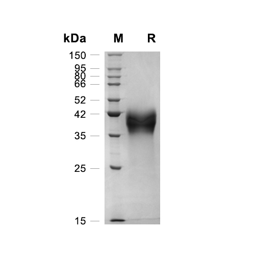 DKK-1蛋白, Rat (HEK293, C-His)