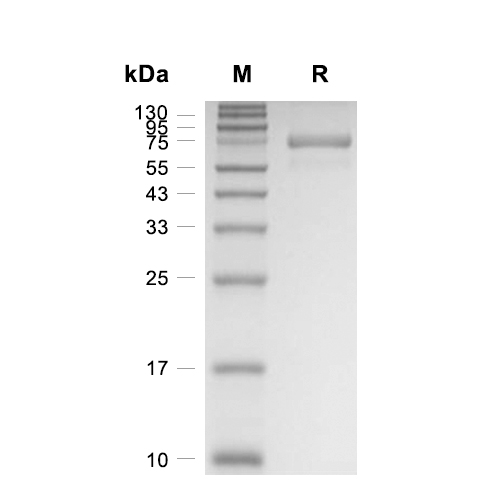 EPHA10蛋白, Cynomolgus (HEK293, His)