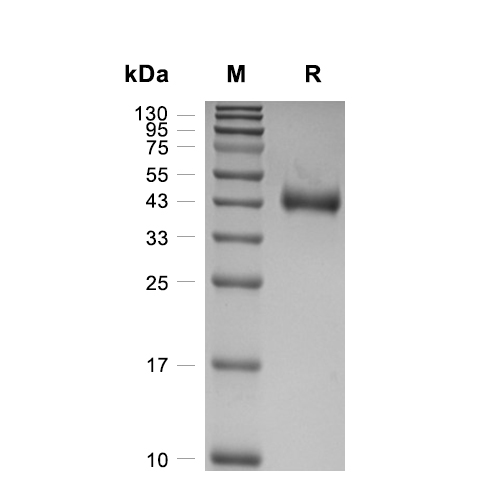 FGL2蛋白, Mouse (HEK293, His-Avi, Flag)