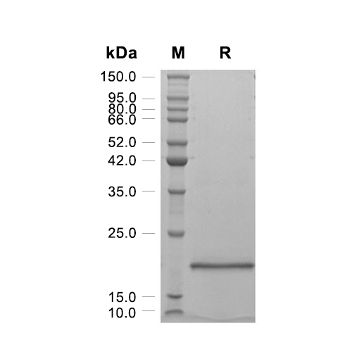 IL-1RA/IL-1RN蛋白, Rat (C-His)