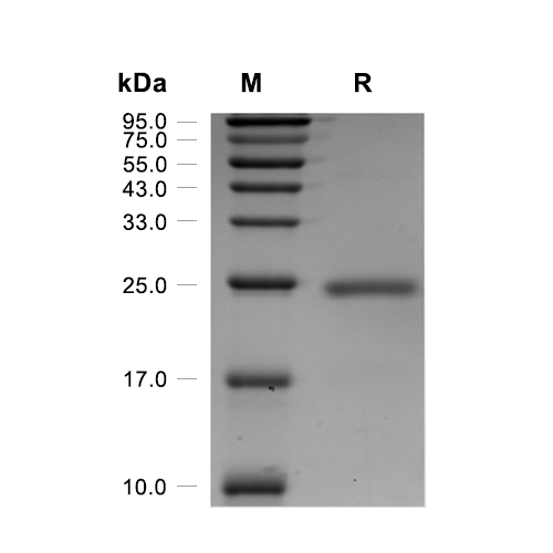 Kras4B蛋白, Human (G13V, His)