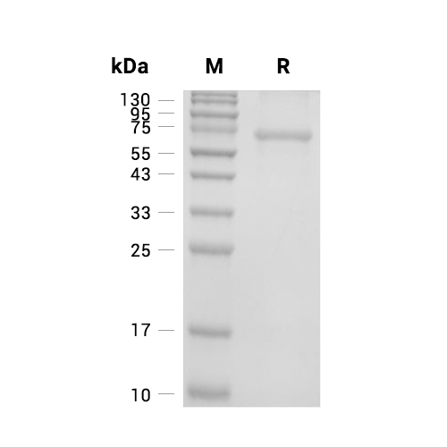 PRKN蛋白, Human (His, SUMO)