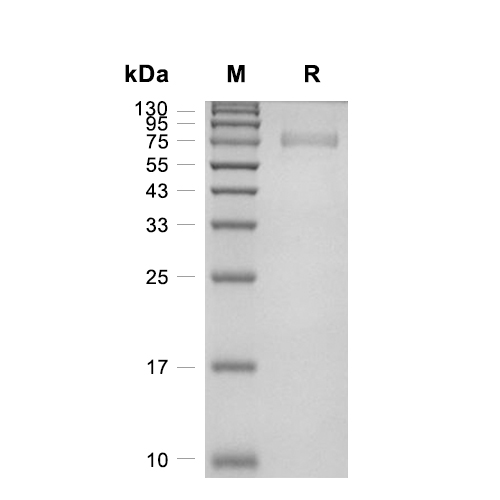 ADAM15蛋白, Human (HEK293, C-His)
