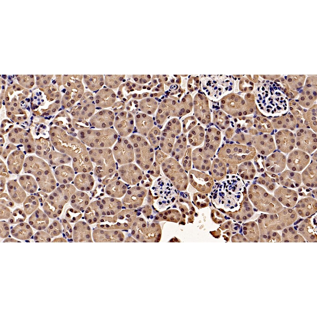 Phospho-JAK2 (Tyr1007+Tyr1008)抗体 (YA181)