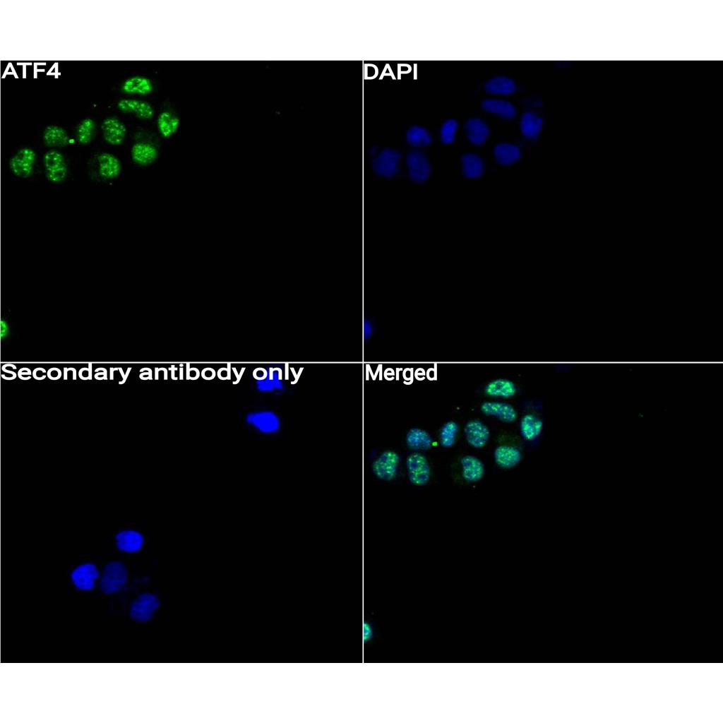 ATF4抗体 (YA605)