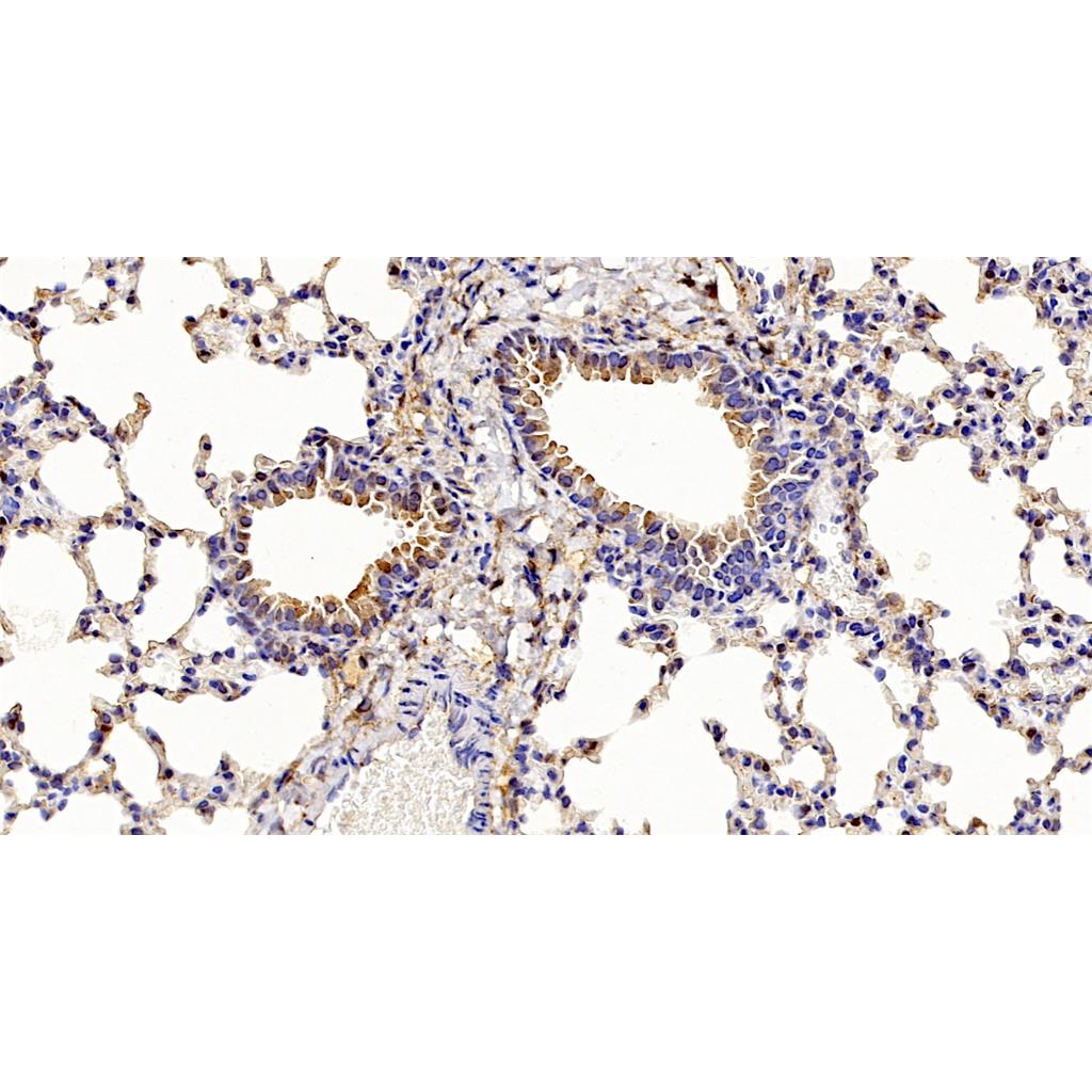 Phospho-eIF4EBP1 (Thr46)抗体 (YA230)