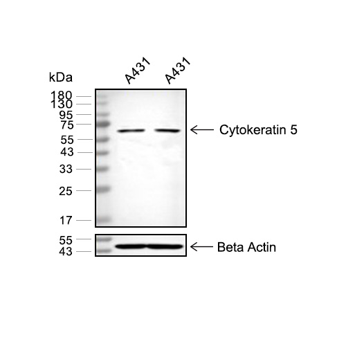 Cytokeratin 5抗体 (YA3509)