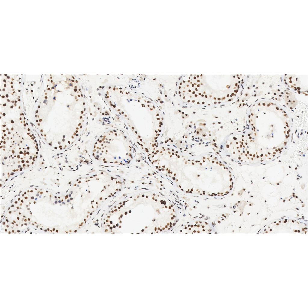 hnRNP K抗体 (YA1194)