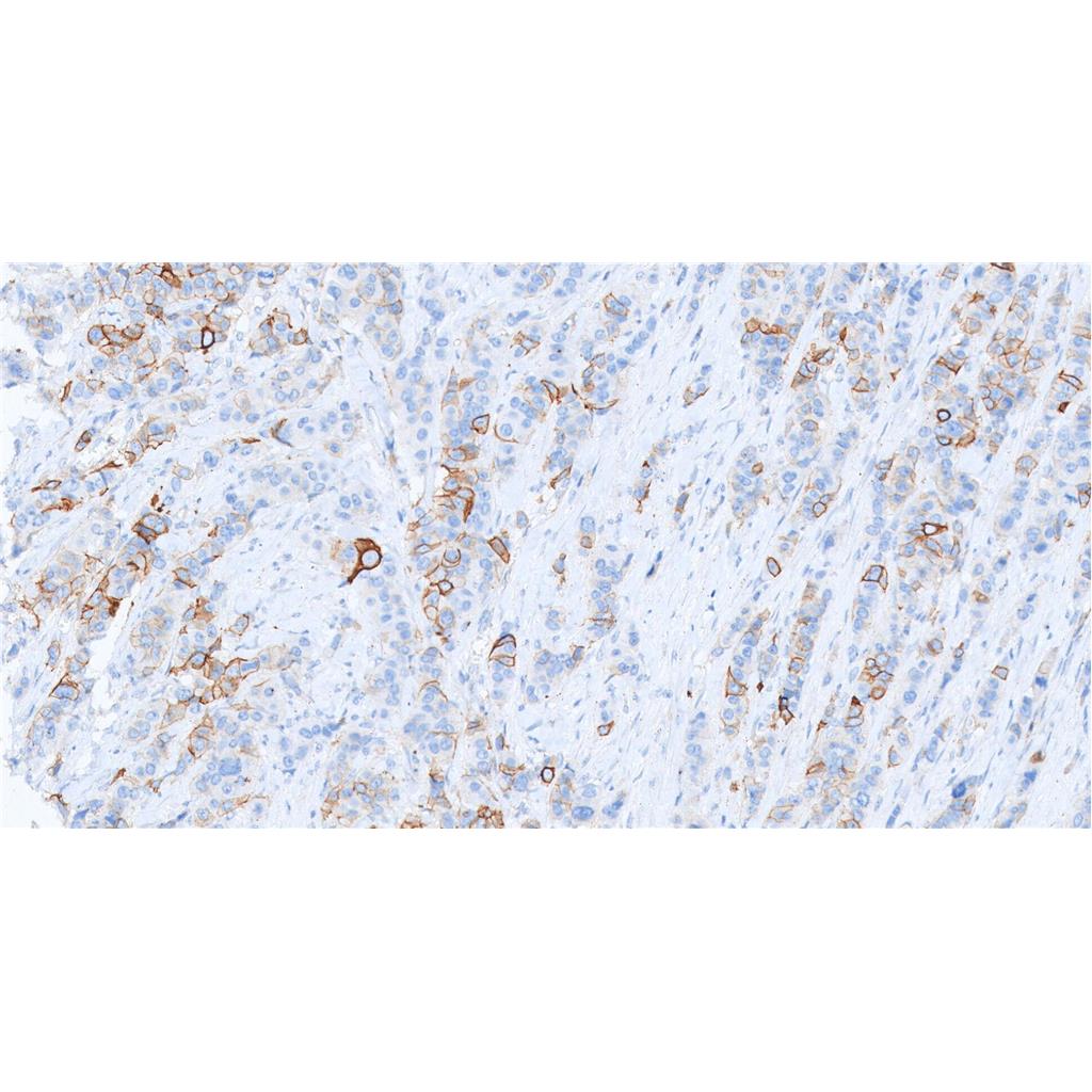 Somatostatin Receptor 2抗体 (YA1197)