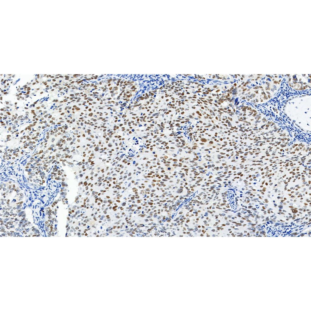 POLD1抗体 (YA1718)