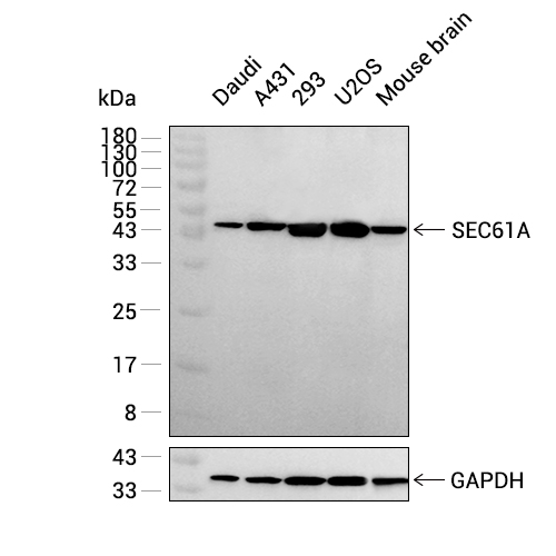 SEC61A抗体 (YA1825)