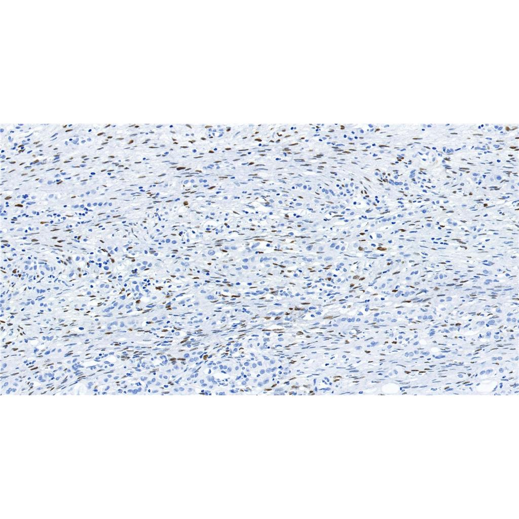 Progesterone Receptor抗体 (YA1866)