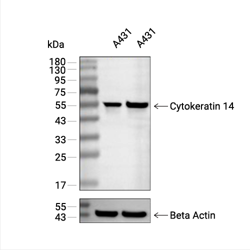 Cytokeratin 14抗体 (YA1876)