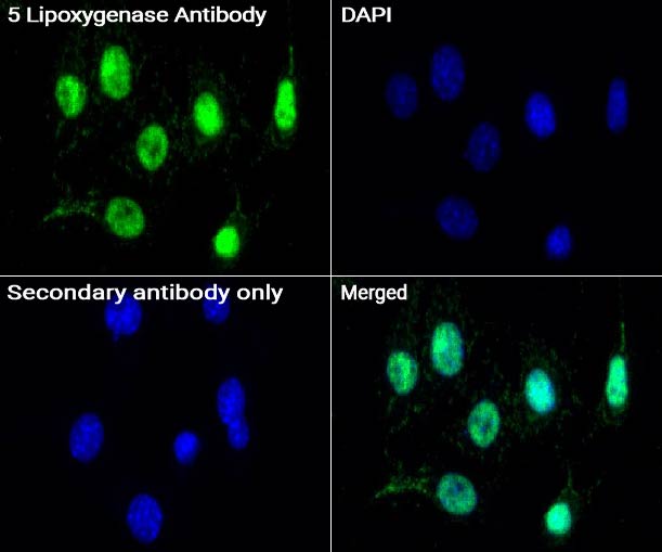5 Lipoxygenase抗体 (YA1937)