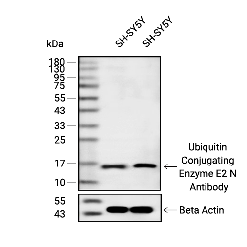 Ubiquitin Conjugating Enzyme E2 N抗体 (YA1978)