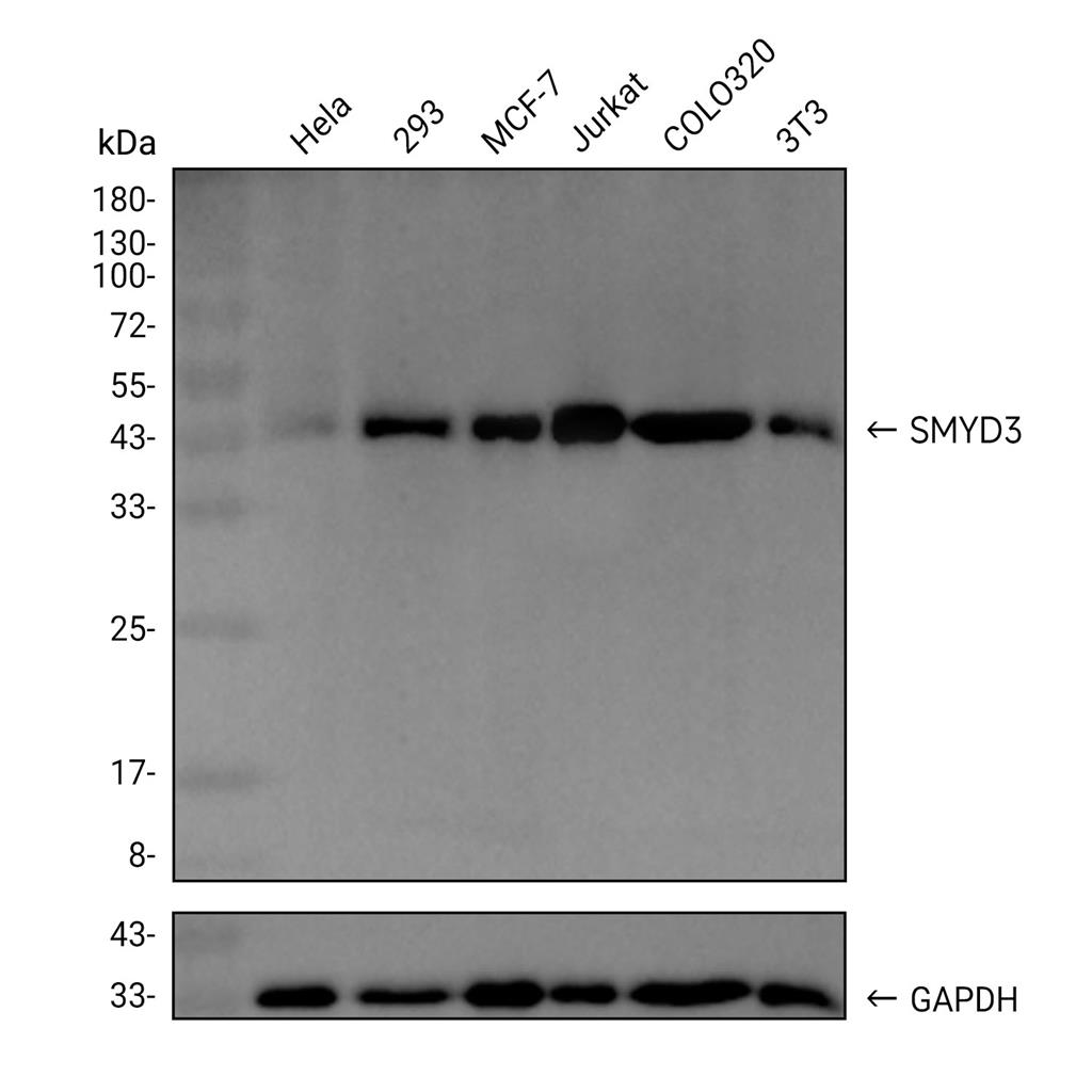 SMYD3抗体 (YA2003)