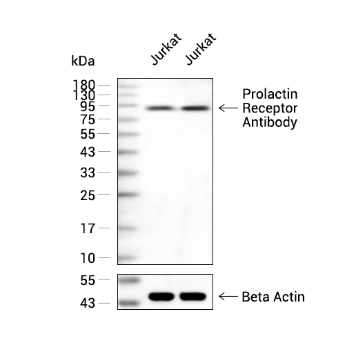 Prolactin Receptor抗体 (YA2411)