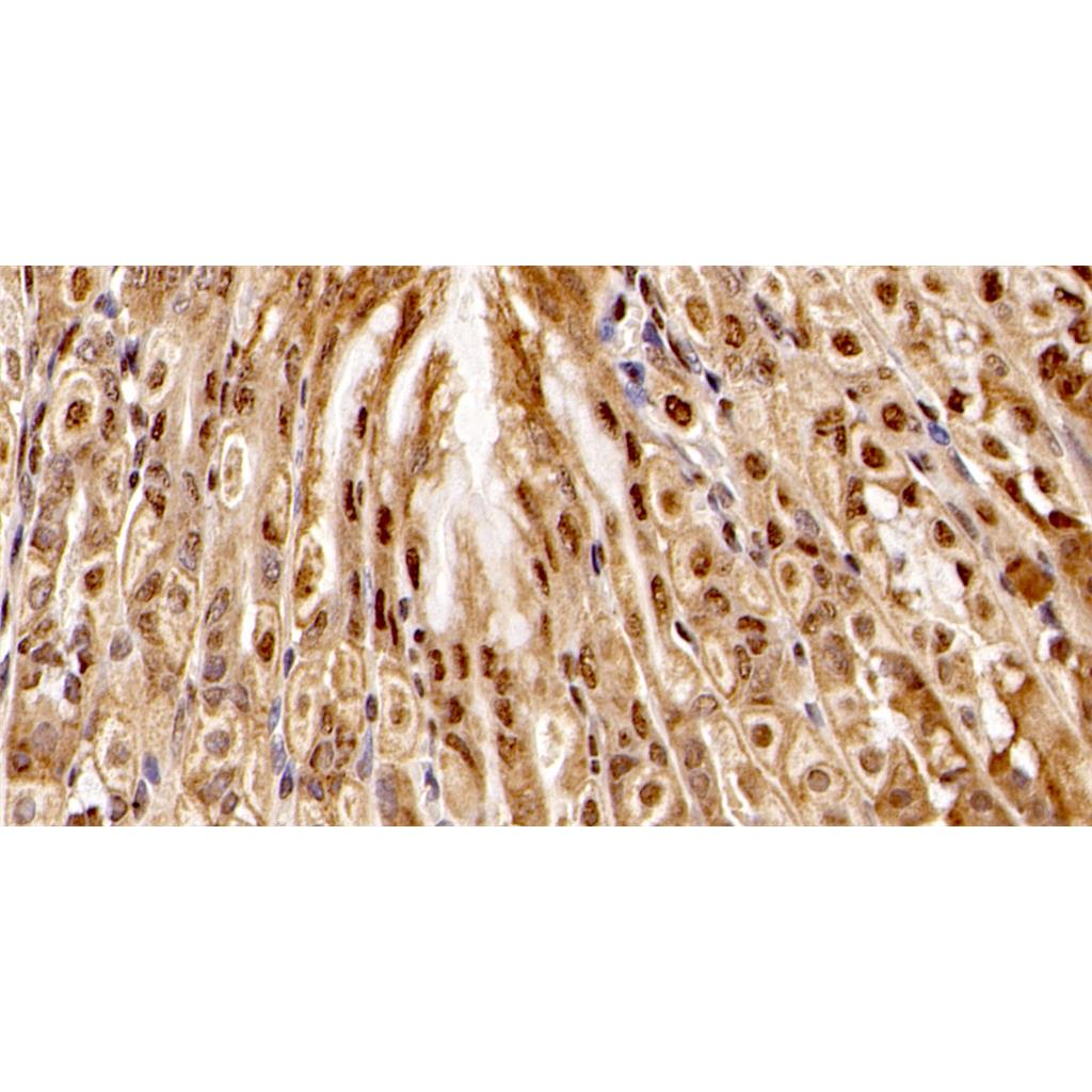 Phospho-SMad2 (S465+467)Antibody (YA3568)