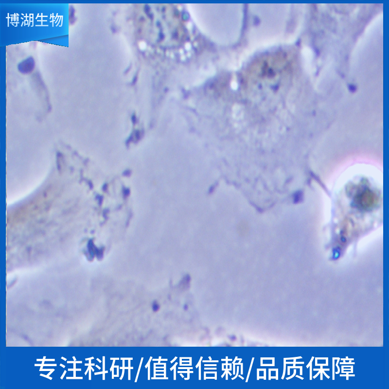 人肝癌细胞+GFP;hepG2-coGFP-PURO