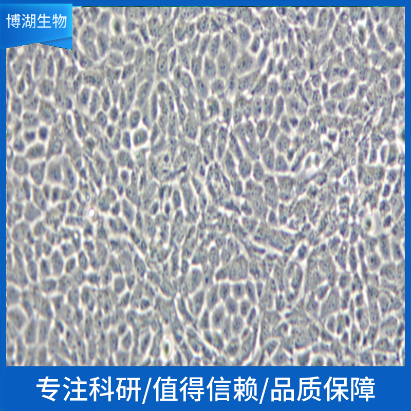 RD人横纹肌肉瘤细胞