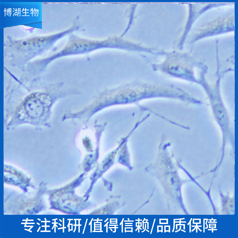 SIHa人子宫颈鳞癌细胞