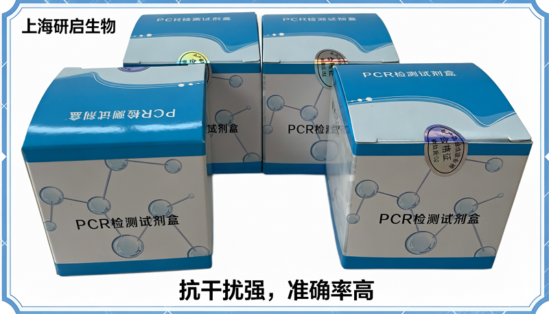 禽流感通用/新城疫病毒(AIV-U/NDV)核酸检测试剂盒(双重荧光-PCR法)