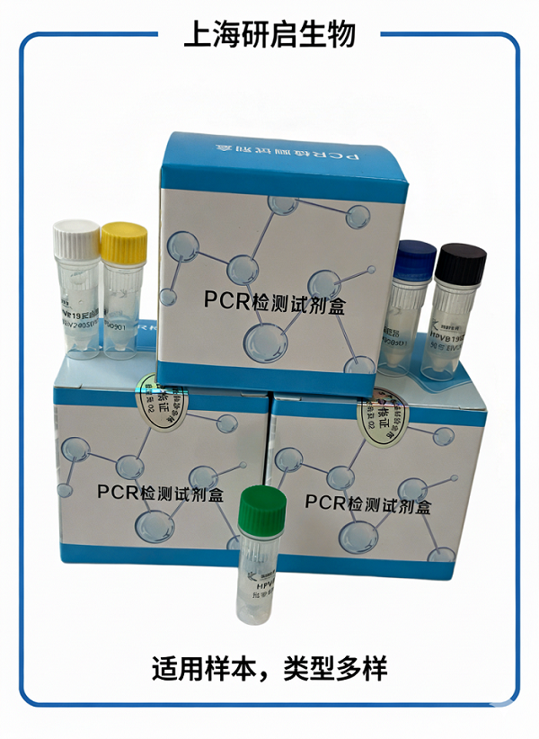 肉毒杆菌B型（CB-B）核酸检测试剂盒