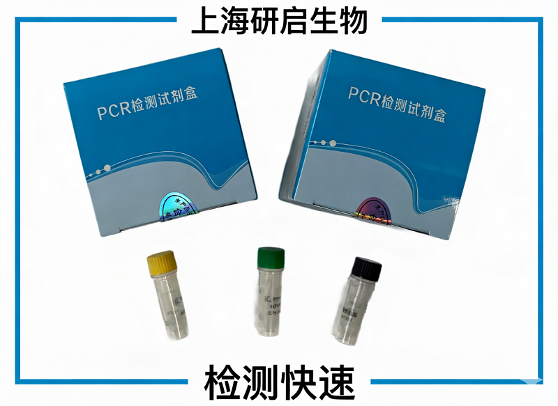 日本乙型脑炎病毒(JEV)核酸检测试剂盒(荧光-PCR法)
