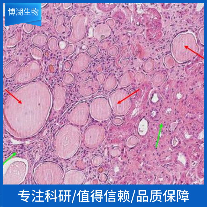 UM-UC-3人膀胱移行细胞癌